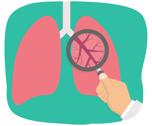 肺の検査