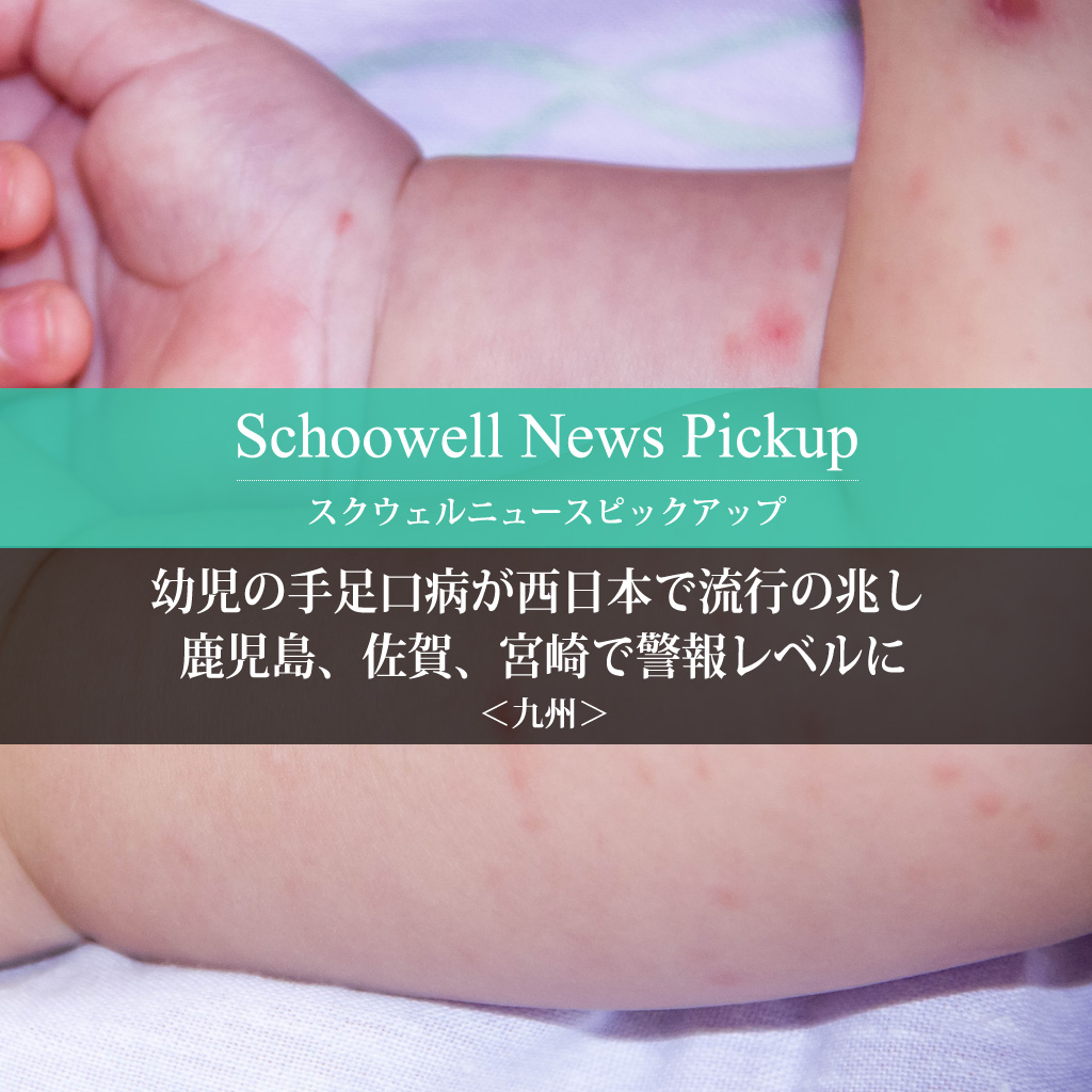 幼児の手足口病が西日本で流行の兆し 　鹿児島、佐賀、宮崎で警報レベルに