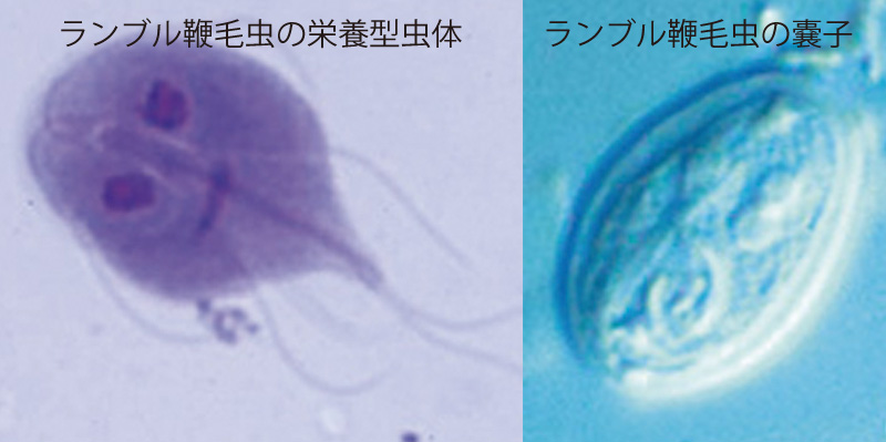 ランブル鞭毛虫の栄養型虫体と嚢子