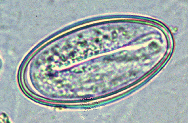 ぎょう虫卵顕微鏡写真：国立感染症研究所