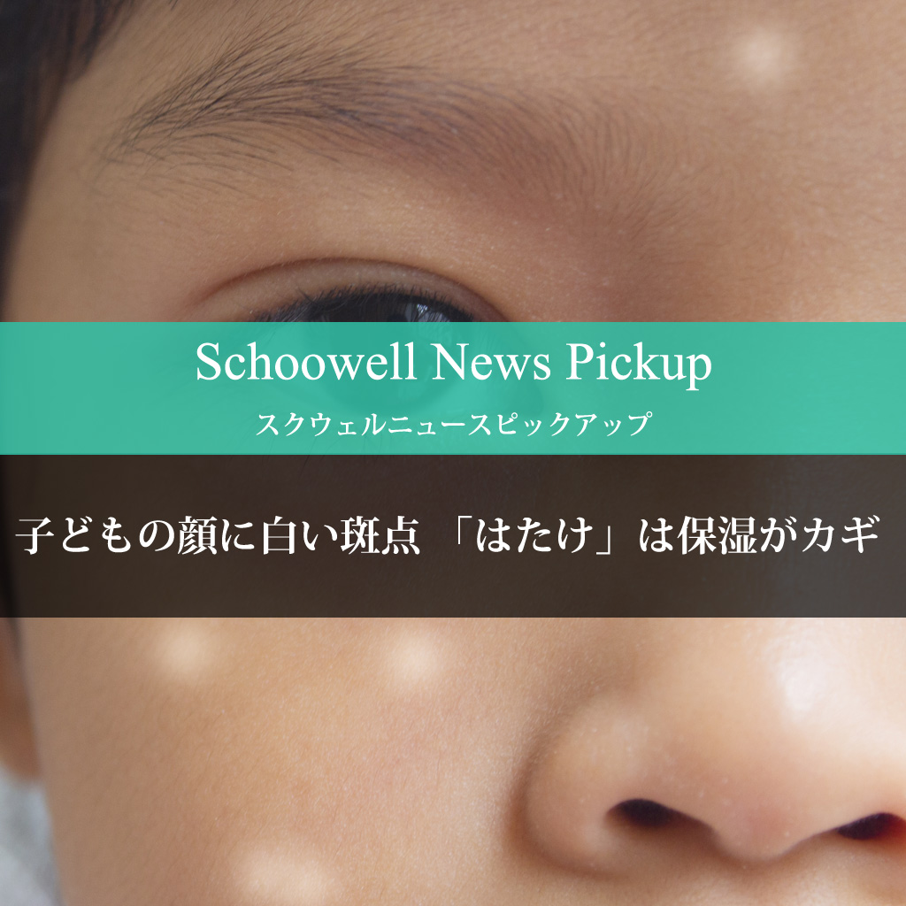 子どもの顔に白い斑点 はたけ は保湿がカギ Schoowell スクウェル