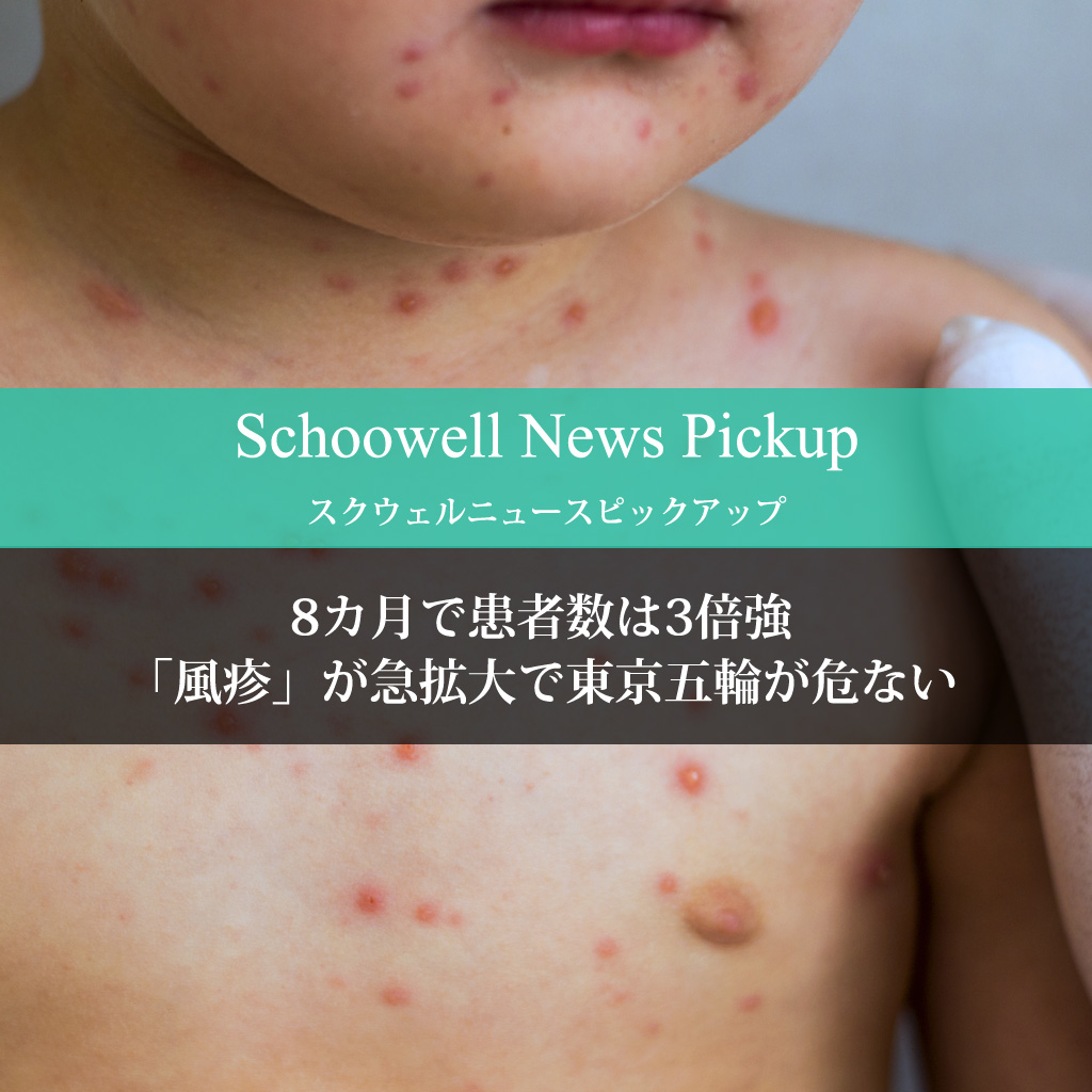 8カ月で患者数は3倍強「風疹」が急拡大で東京五輪が危ない