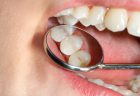 むし歯が1本もない小学生児童の方がむし歯になりやすい、東北大が調査
